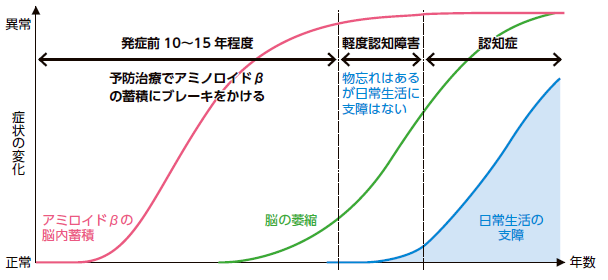アルツハイマー病が発症するまでの経過